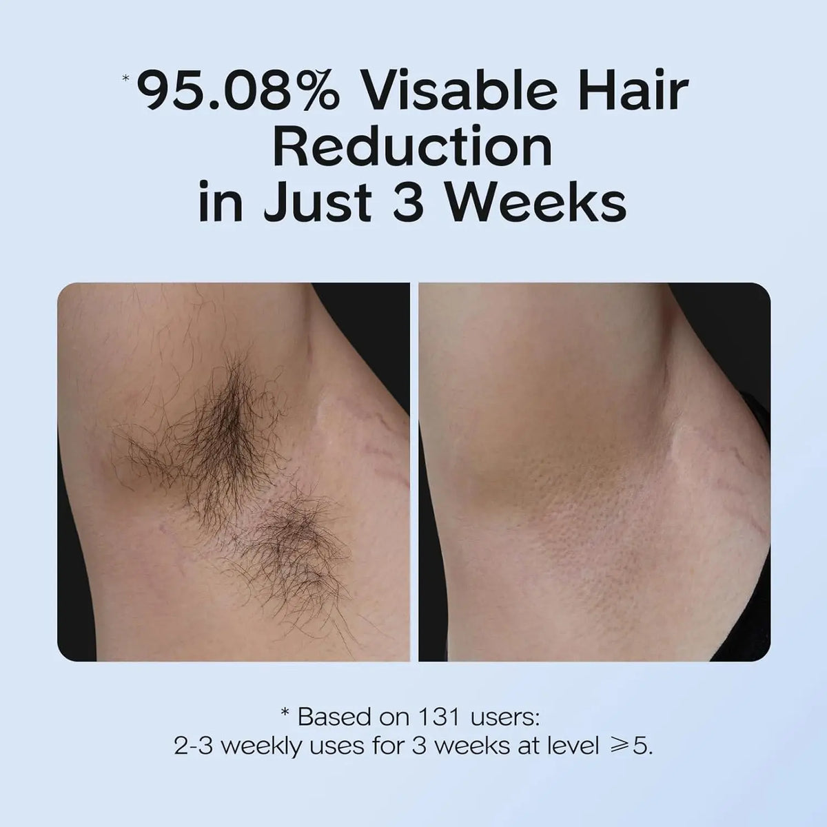 GlacierSkin IPL - Pro Studio