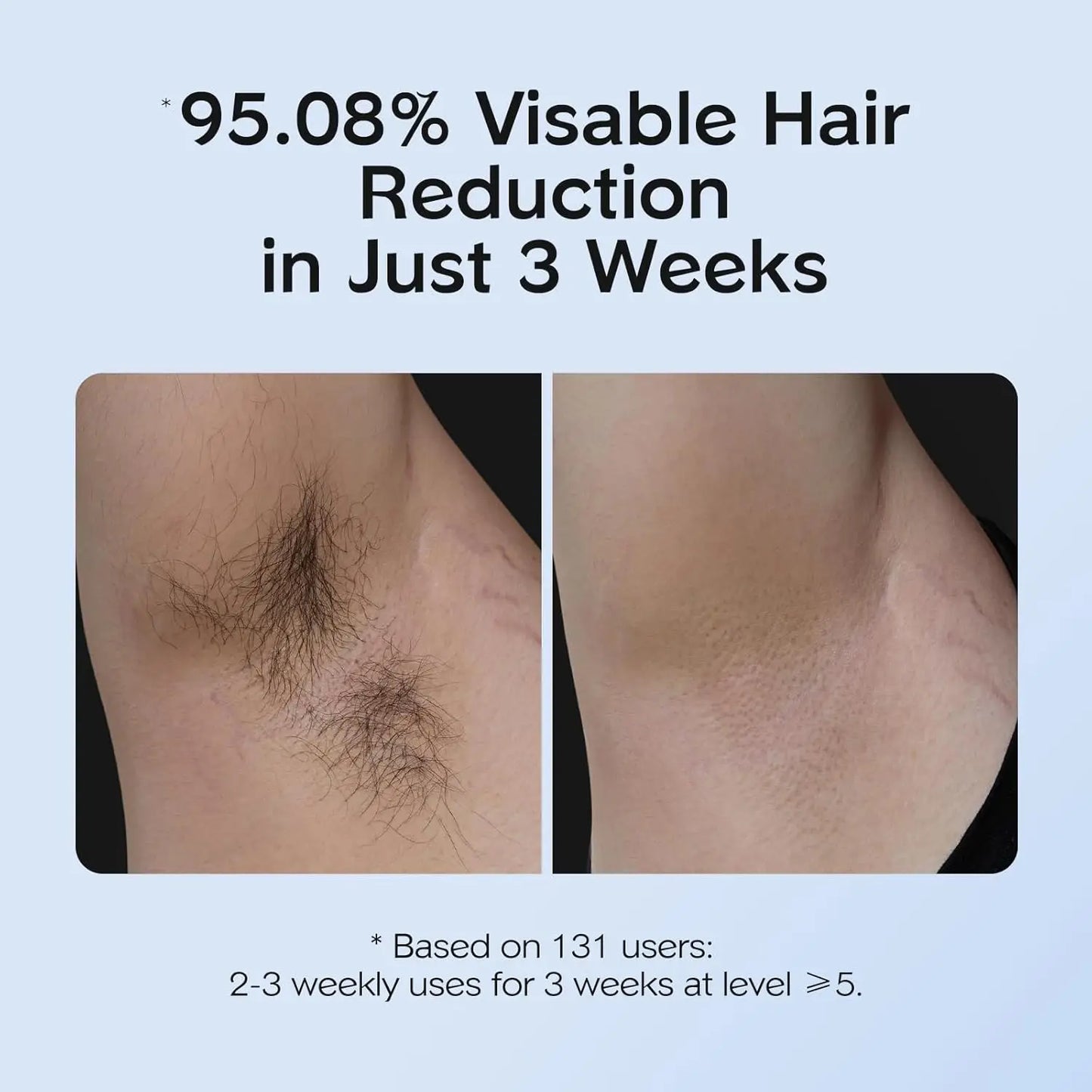 GlacierSkin IPL - Pro Studio